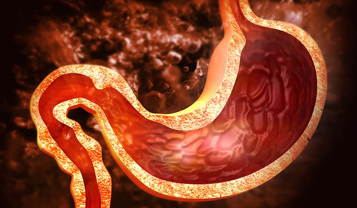 digital cross-section illustration of a stomach